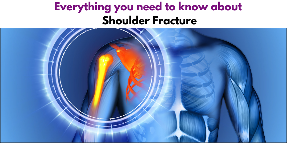 shoulder fracture