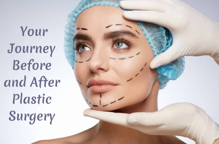 yourjourney before and after plastic surgery