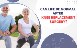 Can Life Be Normal After Knee Replacement Surgery?